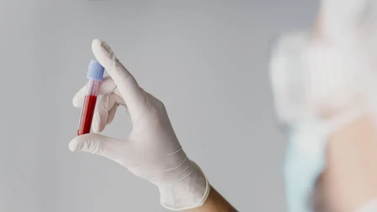 back-view-doctor-holding-blood-sample-07a7029f-focus-min0.5-0.27-896-504